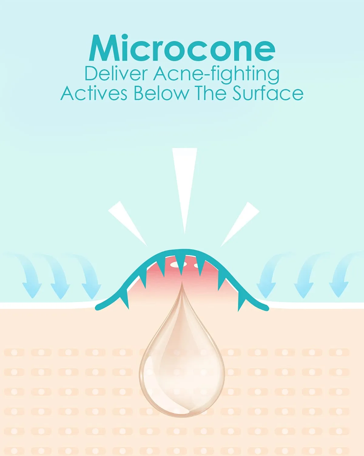  1HEROLABS Microdart Acne Patch (18 Patches) - Hyaluronate, Salicylic Acid, Vitamin C, Microdart Pimple Patch for Deep, Early Stage and Hidden Pimples (18 Count (Pack of 1))