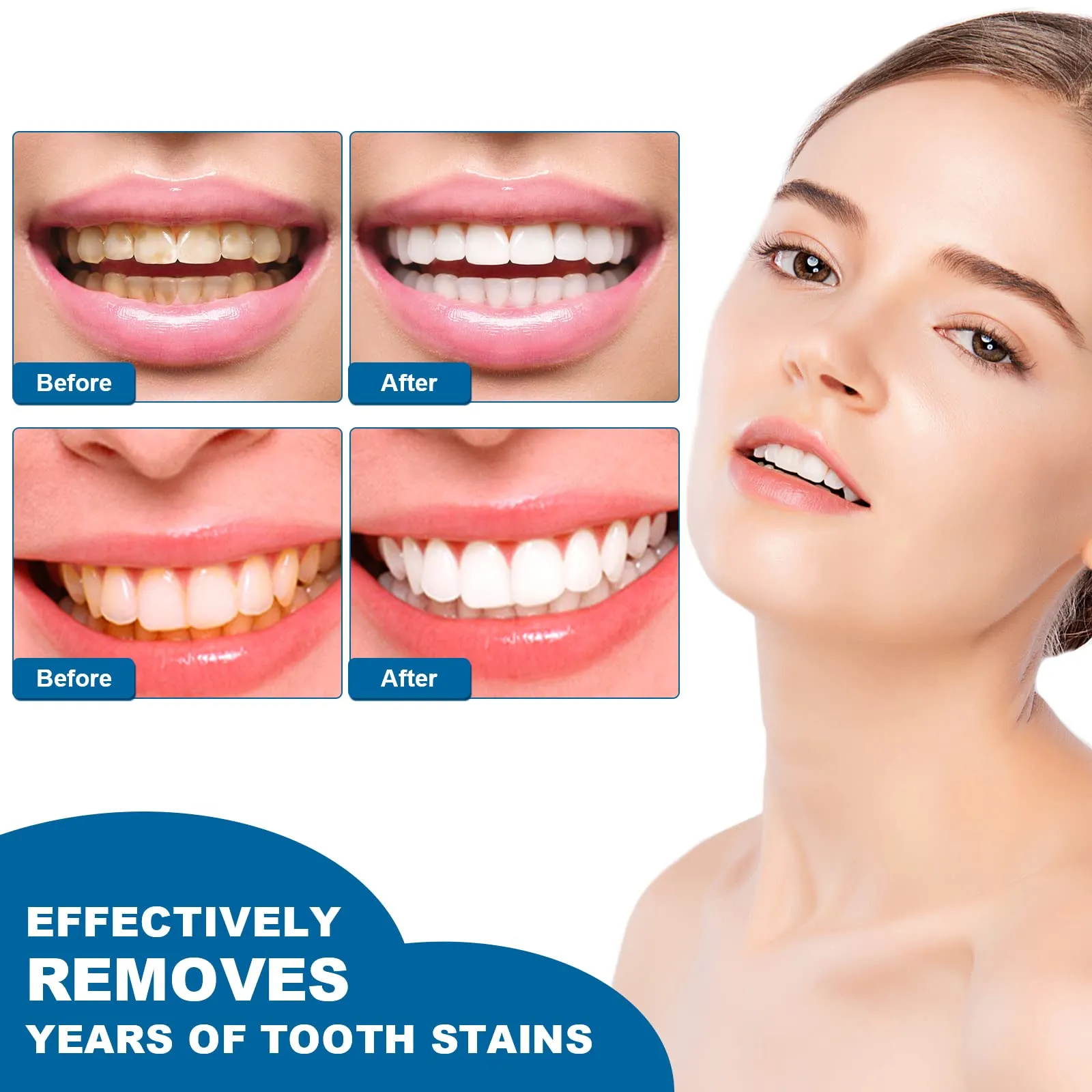 2PCS Teeth Whitening Essence, Teeth Whitening Pen, Instant Teeth Stain Remover Pen, Teeth Whitening Essence Pen, Intensive Stain Removal Teeth Reduce Yellowing
