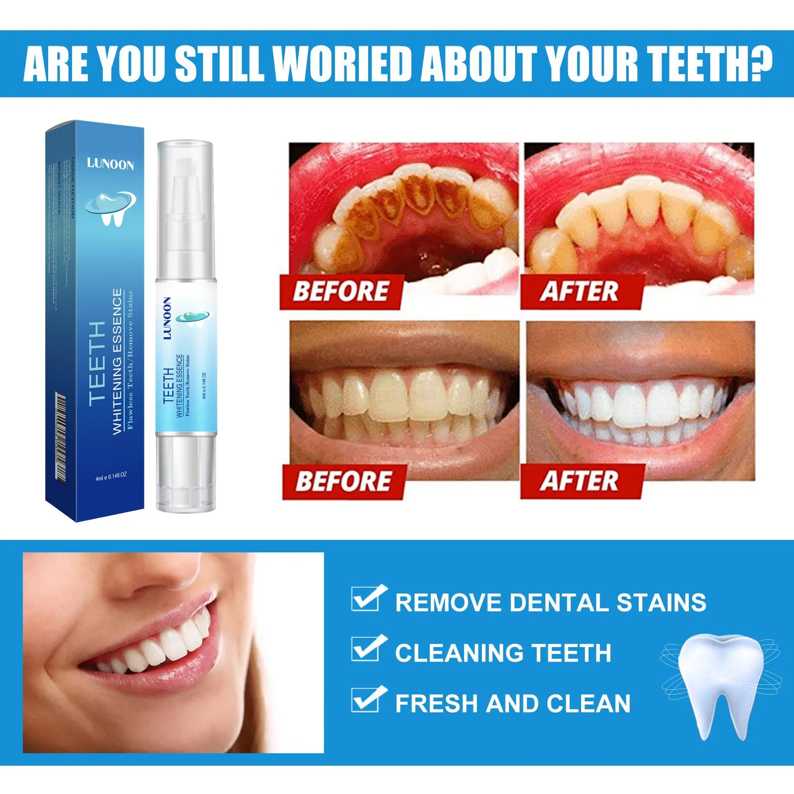 2PCS Teeth Whitening Essence,Teeth Whitening Pen,Teeth Whitening Kit,Teeth Whitening Gel with Soft Toothbrush,No Sensitivity,Easy to Use,Natural Mint Flavor(A) A