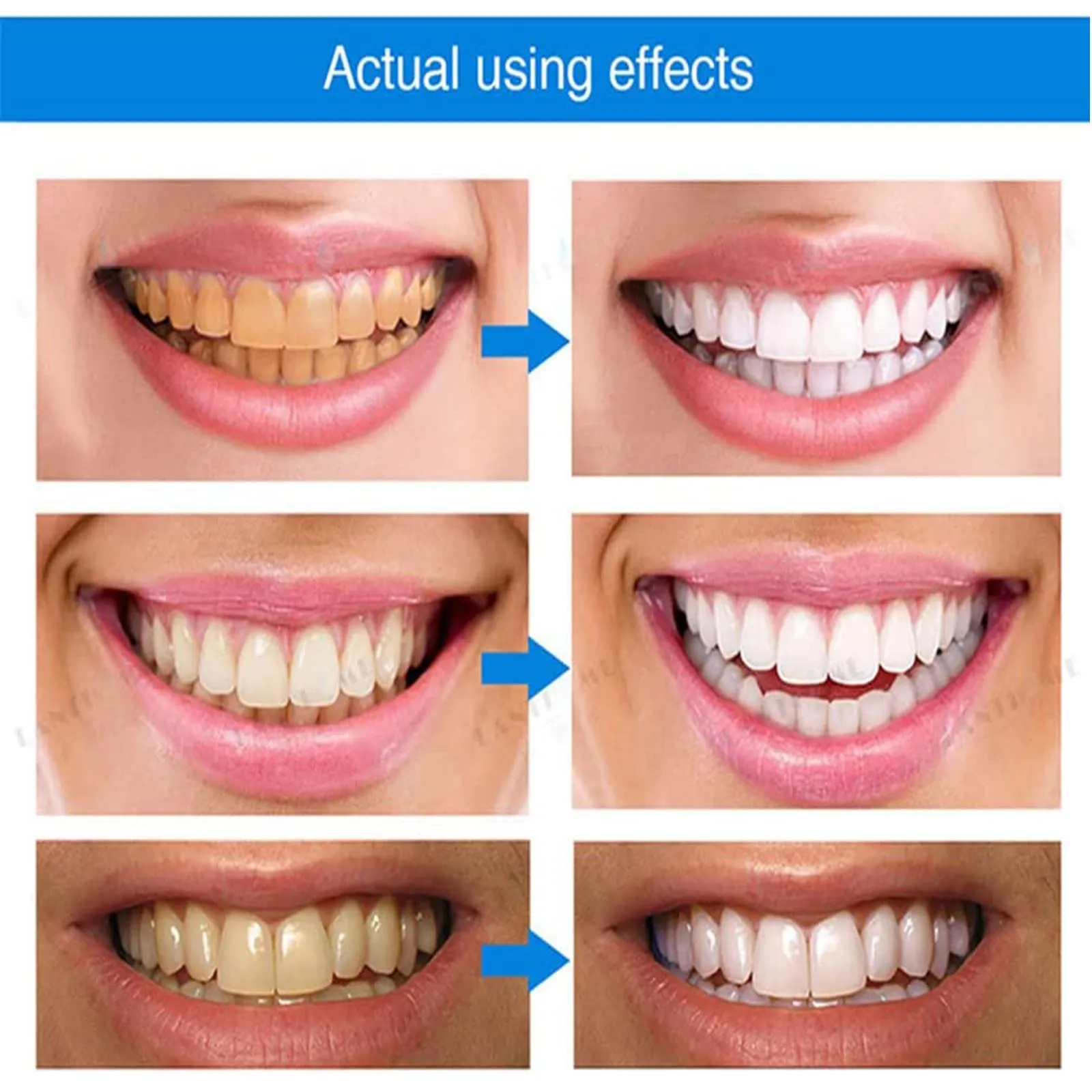 2PCS Teeth Whitening Essence,Teeth Whitening Pen,Teeth Whitening Kit,Teeth Whitening Gel with Soft Toothbrush,No Sensitivity,Easy to Use,Natural Mint Flavor(A) A