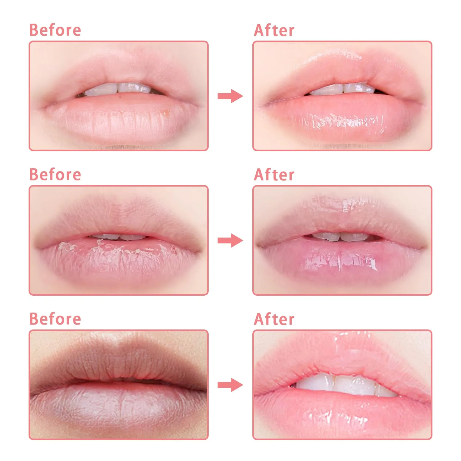 3 Pcs Bee Lip Balm Honey Pot, Coconut Watermelon Apple Lime Lip Mask Overnight, Moisturizing Lip Sleeping Mask, Hydrate Repair Prevent Dry Cracked Lip Exfoliator (Coconut  Watermelon Apple Lime)