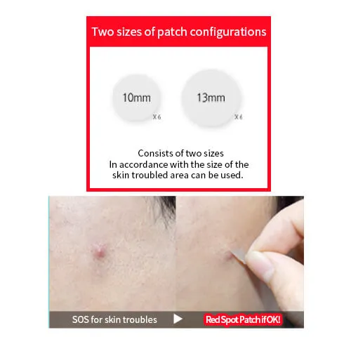 Acne Fighter Kit