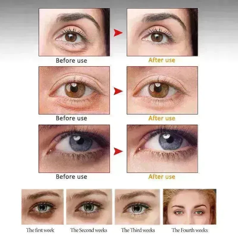 ARTISCARE Anti Wrinkle Eye cream Dark Circle Remover