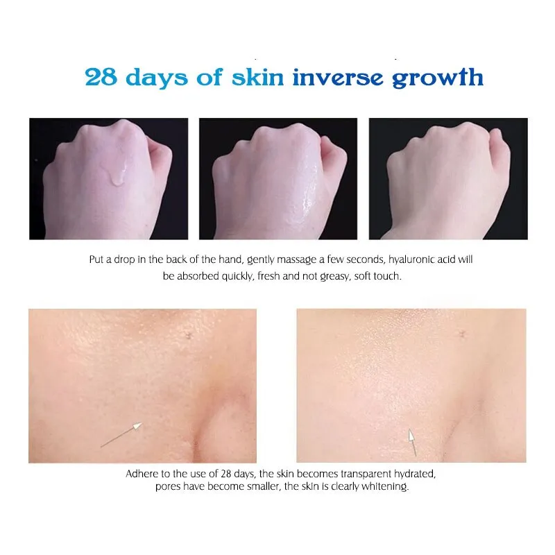 ARTISCARE HA Hyaluronic Acid Serum Moisturizing Essence Skin Face Care Cream Blackhead Acne Treatment Whitening Cream Ageless