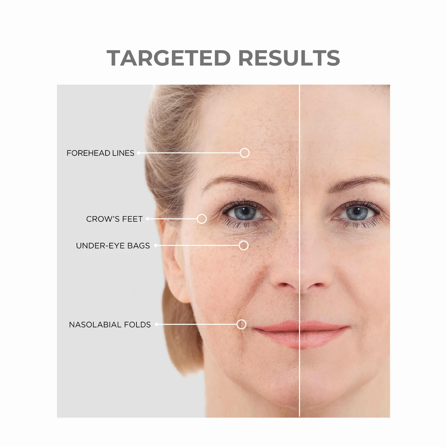 BEAUTICAL Instant Lifting Serum - Anti-Wrinkle, Lifting, Moisturizing - Face & Eye Contour - Hyaluronic Acid & Peptides - 15ml