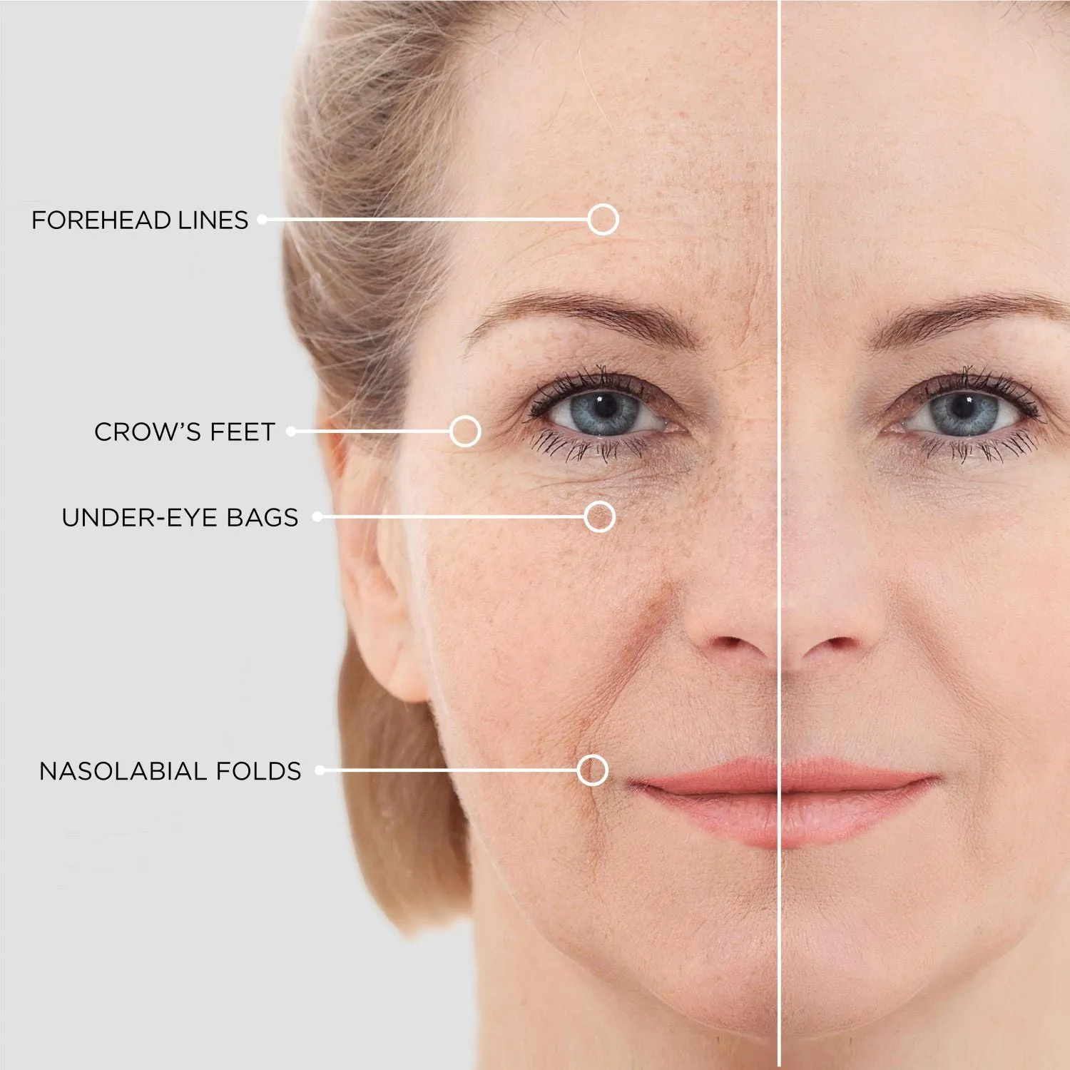 BEAUTICAL Instant Lifting Serum - Anti-Wrinkle, Lifting, Moisturizing - Face & Eye Contour - Hyaluronic Acid & Peptides - 15ml