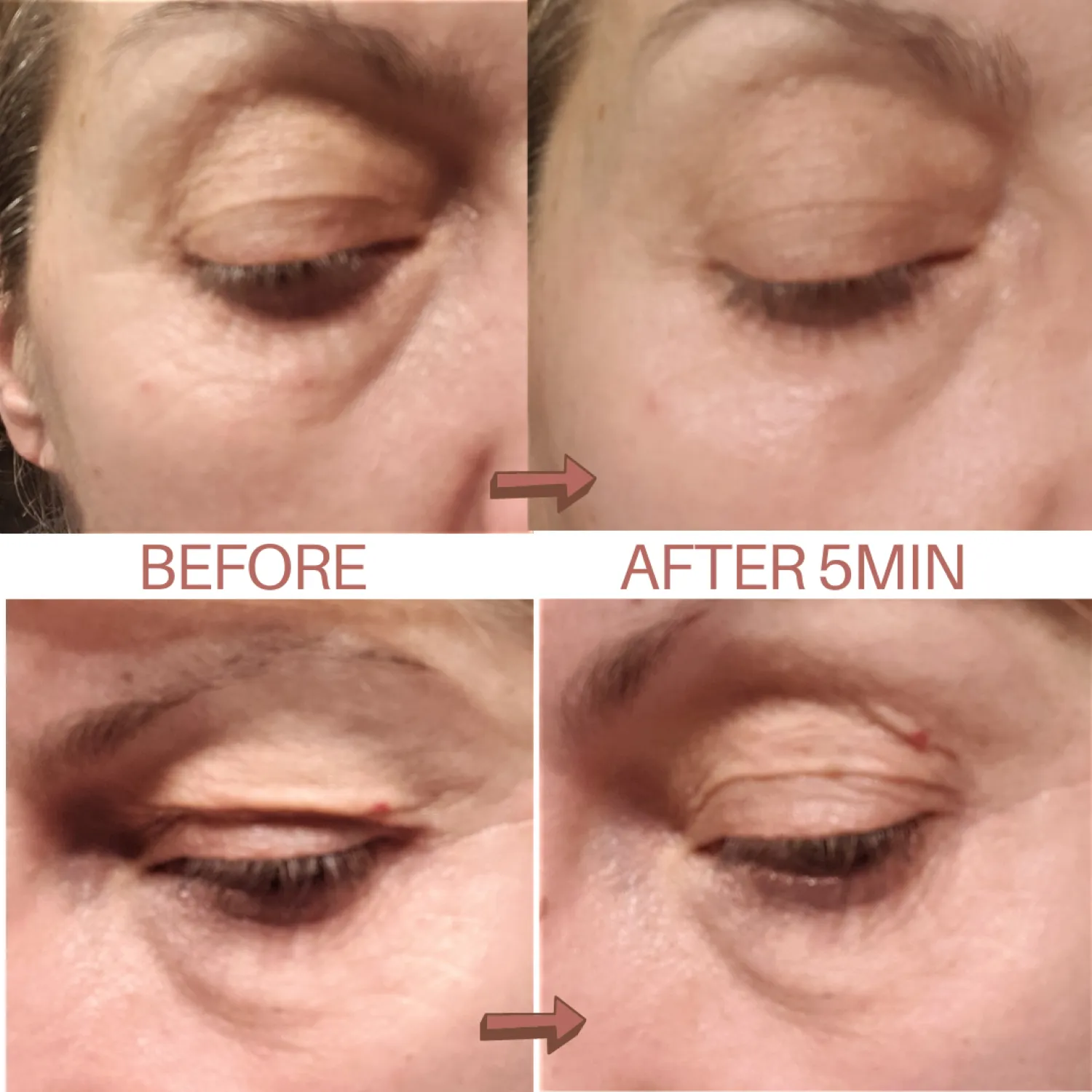 BEAUTICAL Instant Lifting Serum - Anti-Wrinkle, Lifting, Moisturizing - Face & Eye Contour - Hyaluronic Acid & Peptides - 15ml