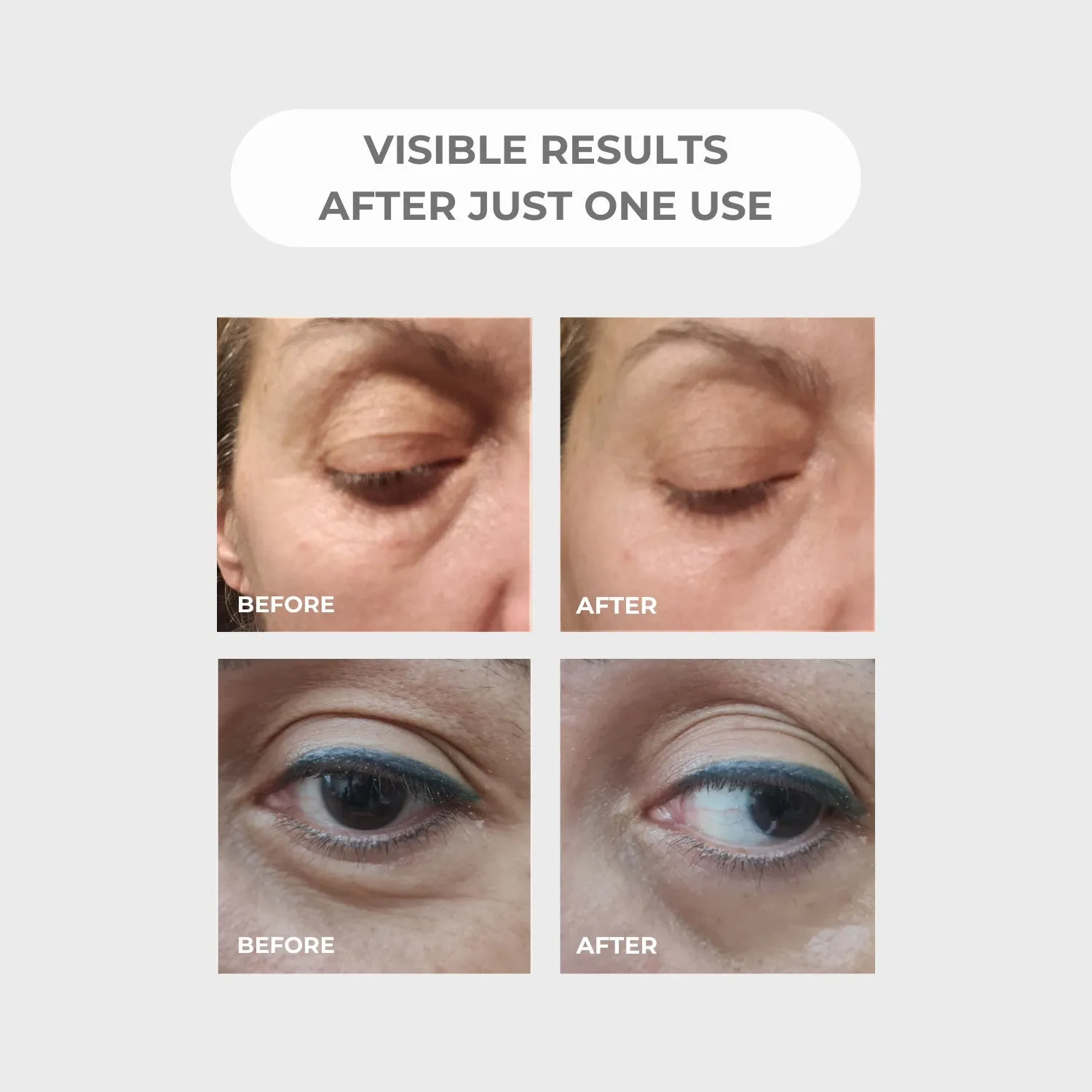 BEAUTICAL Instant Lifting Serum - Anti-Wrinkle, Lifting, Moisturizing - Face & Eye Contour - Hyaluronic Acid & Peptides - 15ml