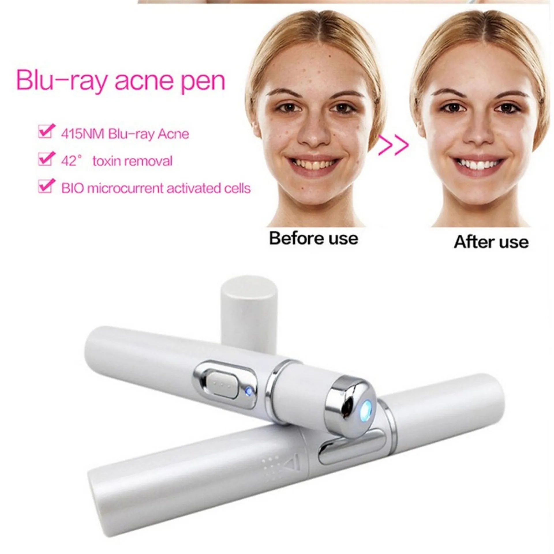 Blue Light Therapy Acne Laser Pen: Softens Scars and Reduces Wrinkles. Remove Treatments for Skin Care and Beauty Equipment.