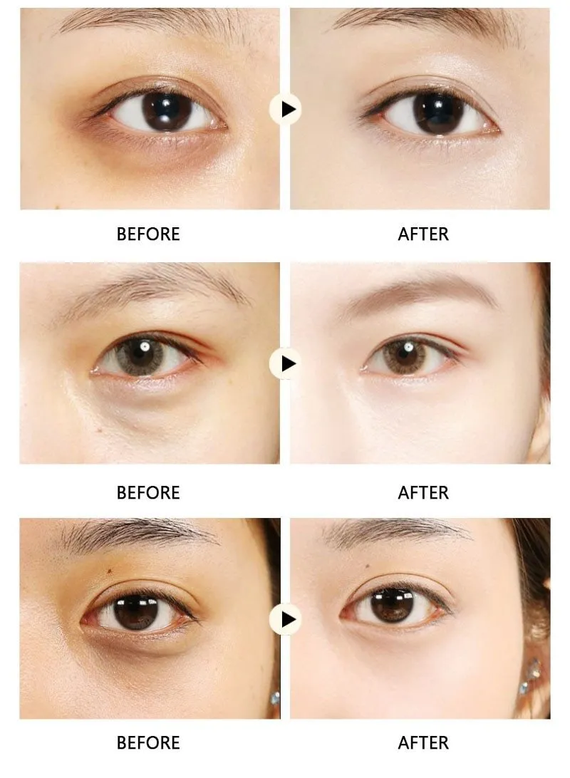 Crystal Collagen Anti Wrinkle Anti Aging Snail Serum Moisturising Eye Mask Patch