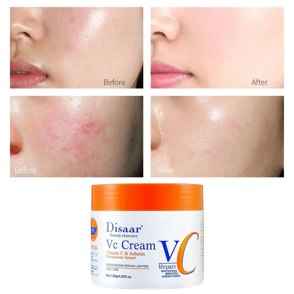 Disaar VC Face Moisturizer Cream - 120g