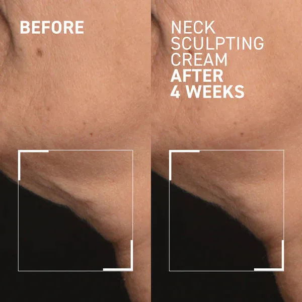 Dr. Brandt Needles No More Neck Sculpting Cream, 1.7oz.