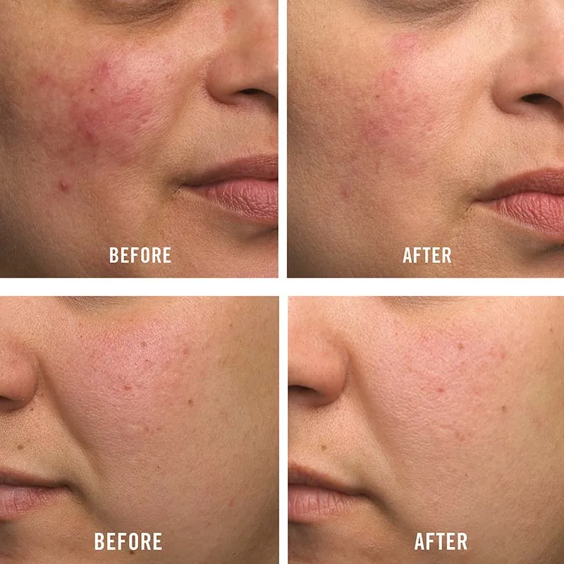 First Aid Beauty Ultra Repair Cream