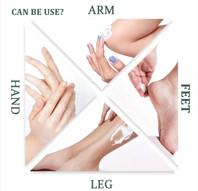 Foot Repair Cream - Cracked Heels - Callus Removal - Baby like Soft Feets