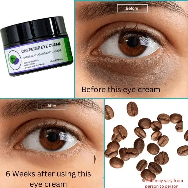 Khichi Beauty Caffeine Eye Cream