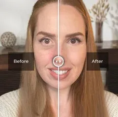 ORIGINAL™ Instant Firmx – Best Under Eye Cream for Bags