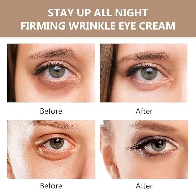ORIGINAL™ Instant Firmx – Best Under Eye Cream for Bags
