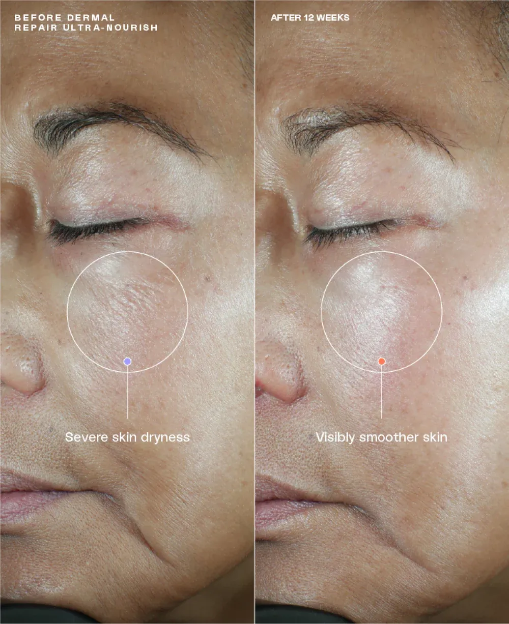 Sente Dermal Repair Duo*