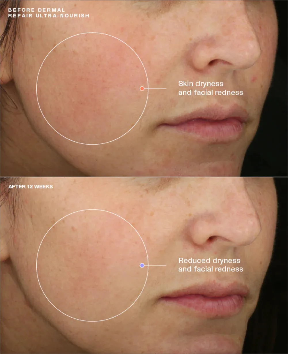 Sente Dermal Repair Duo*