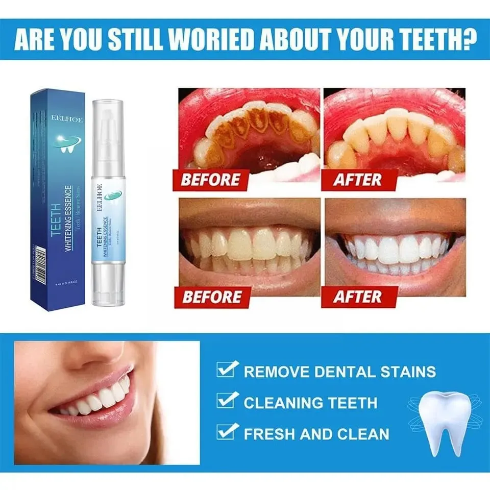 Teeth Whitening Essence Teeth Whitening Lanthome Teeth Pen