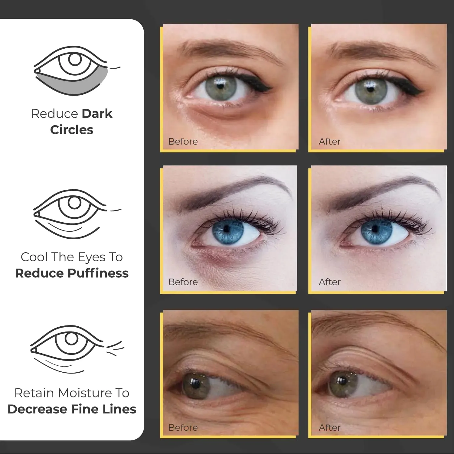 Under Eye Patches for Puffy Eyes and Dark Circles (60 Pairs) | Infused Gel Eye Mask Patches for Dark Circle Under Eye Support of Eye Bags & Puffiness | Ideal for Bridesmaids Gifts & Bachelorette Party