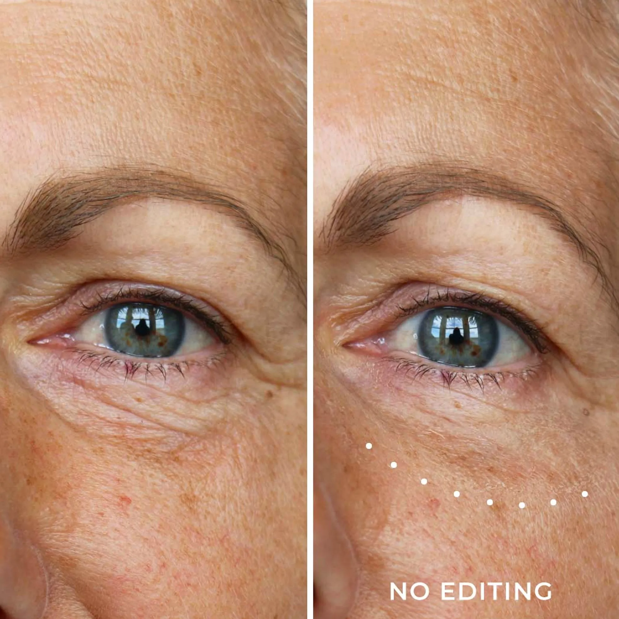 WUNDERLIFT 60 Second Wrinkle Reducer